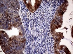 CDKN2A Monoclonal Antibody (OTI10F12), TrueMAB , OriGene 100 &mu;L; Unconjugated:Antibodies,