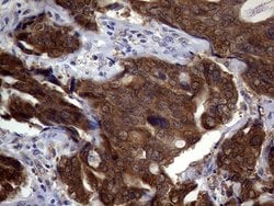 CDKN2A Monoclonal Antibody (OTI10F12), TrueMAB , OriGene 100 &mu;L; Unconjugated:Antibodies,