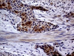 CDKN2A Monoclonal Antibody (OTI10F12), TrueMAB , OriGene 100 &mu;L; Unconjugated:Antibodies,