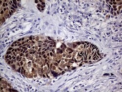 CDKN2A Mouse anti-Human, Clone: OTI11E9, lyophilized, TrueMAB 100 &mu;g;