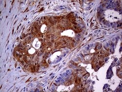CDKN2A Mouse anti-Human, Clone: OTI11E9, lyophilized, TrueMAB 100 &mu;g;