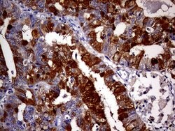 CDKN2A Mouse anti-Human, Clone: OTI11E9, lyophilized, TrueMAB 100 &mu;g;