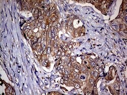 CDKN2A Mouse anti-Human, Clone: OTI11E9, lyophilized, TrueMAB 100 &mu;g;