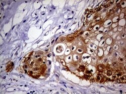 CDKN2A Mouse anti-Human, Clone: OTI11E9, lyophilized, TrueMAB 100 &mu;g;