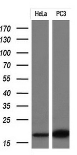 CDKN2A (p16INK4a) Monoclonal Antibody (OTI8A1), TrueMAB , OriGene 100 &mu;L;