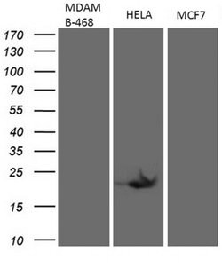 CDKN2A Monoclonal Antibody (OTI3G3), TrueMAB , OriGene 100 &mu;L; Unconjugated:Antibodies,