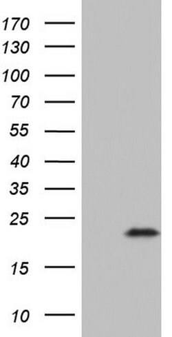 CDKN2A Mouse anti-Human, Clone: OTI1D3, lyophilized, TrueMAB 100 &mu;g;