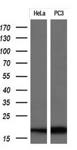 CDKN2A Mouse anti-Human, Clone: OTI1D3, lyophilized, TrueMAB 100 &mu;g;