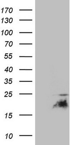 CDKN2A Monoclonal Antibody (OTI13E10), TrueMAB , OriGene 100 &mu;L; Unconjugated:Antibodies,