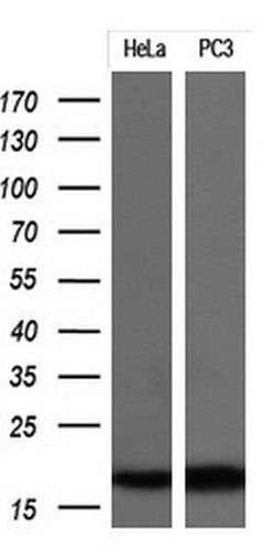 CDKN2A (p16INK4a) Monoclonal Antibody (OTI12C2), TrueMAB , OriGene 100