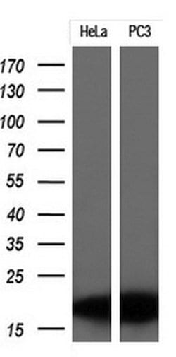 CDKN2A (p16INK4a) Monoclonal Antibody (OTI9A2), TrueMAB , OriGene 100 &mu;L;