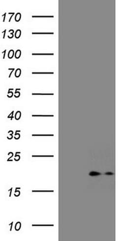 CDKN2A Monoclonal Antibody (OTI1F5), TrueMAB , OriGene 100 &mu;L; Unconjugated:Antibodies,