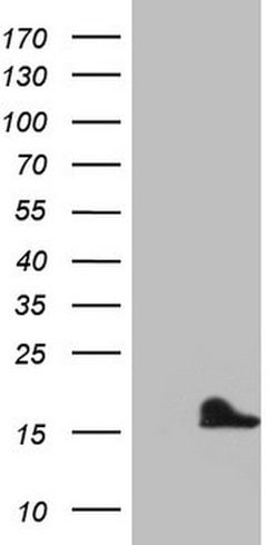CDKN2A Mouse anti-Human, Clone: OTI5H5, lyophilized, TrueMAB 100 &mu;g;
