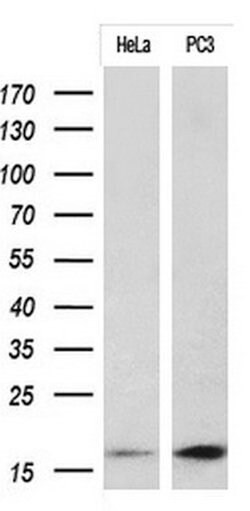 CDKN2A Mouse anti-Human, Clone: OTI5H5, lyophilized, TrueMAB 100 &mu;g;