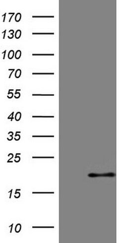 CDKN2A Monoclonal Antibody (OTI4E9), TrueMAB , OriGene 100 &mu;L; Unconjugated:Antibodies,