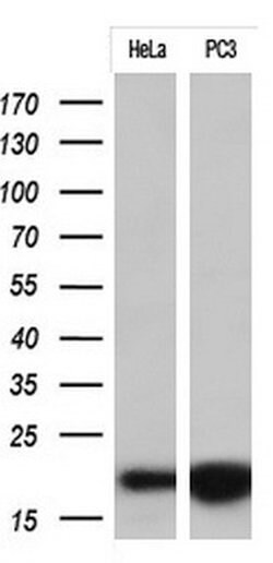 CDKN2A (p16INK4a) Monoclonal Antibody (OTI1H10), TrueMAB , OriGene 100