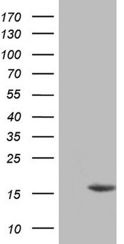 CDKN2A Mouse anti-Human, Clone: OTI2H7, lyophilized, TrueMAB 100 &mu;g;