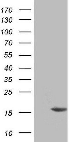 CDKN2A (p16INK4a) Monoclonal Antibody (OTI2H7), TrueMAB , OriGene 100 &mu;L;