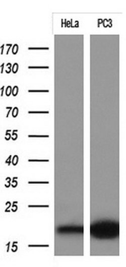 CDKN2A Mouse anti-Human, Clone: OTI2H7, lyophilized, TrueMAB 100 &mu;g;