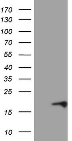 CDKN2A Mouse anti-Human, Clone: OTI8E9, lyophilized, TrueMAB 100 &mu;g;