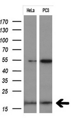 CDKN2A Mouse anti-Human, Clone: OTI8E9, lyophilized, TrueMAB 100 &mu;g;