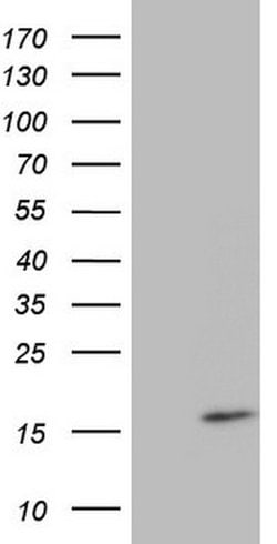 CDKN2A Mouse anti-Human, Clone: OTI1F10, lyophilized, TrueMAB 100 &mu;g;