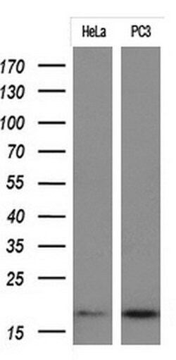 CDKN2A Mouse anti-Human, Clone: OTI1F10, lyophilized, TrueMAB 100 &mu;g;