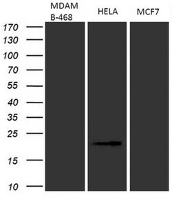 CDKN2A Monoclonal Antibody (OTI7B10), TrueMAB , OriGene:Antibodies:Primary