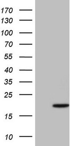 CDKN2A (p16INK4a) Monoclonal Antibody (OTI7H6), TrueMAB , OriGene 30 &mu;L;
