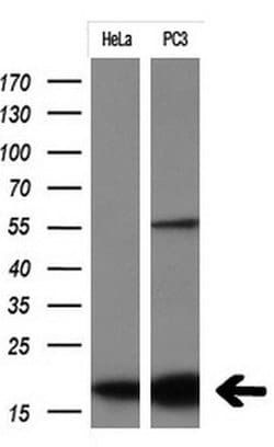 CDKN2A (p16INK4a) Monoclonal Antibody (OTI7H6), TrueMAB , OriGene 30 &mu;L;