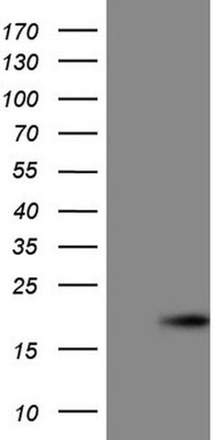 CDKN2A (p16INK4a) Monoclonal Antibody (OTI1E7), TrueMAB , OriGene:Antibodies:Primary
