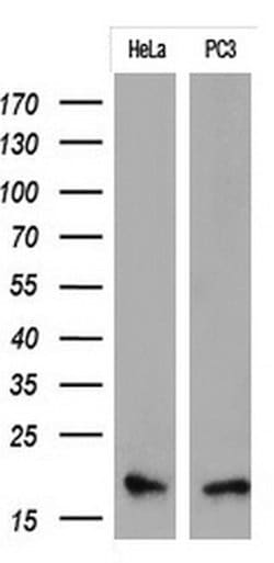 CDKN2A (p16INK4a) Monoclonal Antibody (OTI1E7), TrueMAB , OriGene:Antibodies:Primary