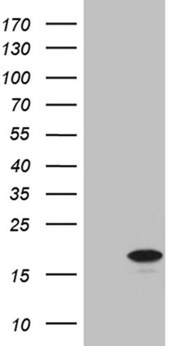 CDKN2A Monoclonal Antibody (OTI4H4), TrueMAB , OriGene 100 &mu;L; Unconjugated:Antibodies,