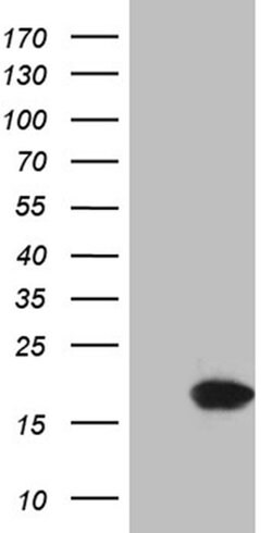 CDKN2A Monoclonal Antibody (OTI10F12), TrueMAB , OriGene 100 &mu;L; Unconjugated:Antibodies,