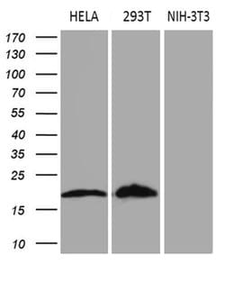 CDKN2A Monoclonal Antibody (OTI10F12), TrueMAB , OriGene 100 &mu;L; Unconjugated:Antibodies,