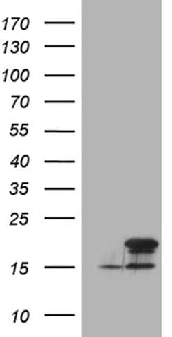 CDKN2A Mouse anti-Human, Clone: OTI11E9, lyophilized, TrueMAB 100 &mu;g;