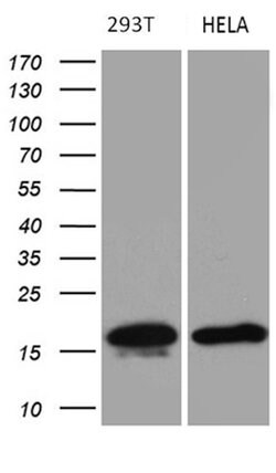 CDKN2A Mouse anti-Human, Clone: OTI11E9, lyophilized, TrueMAB 100 &mu;g;