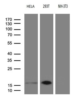 CDKN2A Monoclonal Antibody (OTI4E11), TrueMAB , OriGene:Antibodies:Primary