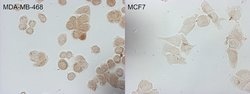 CDKN2A (p16INK4a) Mouse anti-Human, Clone: OTI2C5, lyophilized, TrueMAB