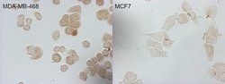 CDKN2A (p16INK4a) Monoclonal Antibody (OTI2C5), TrueMAB , OriGene 100 &mu;L;