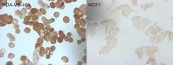 CDKN2A (p16INK4a) Monoclonal Antibody (OTI3F2), TrueMAB , OriGene 100 &mu;L;
