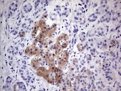 CDKN2A (p16INK4a) Mouse anti-Human, Clone: OTI2C5, lyophilized, TrueMAB