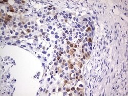 CDKN2A (p16INK4a) Mouse anti-Human, Clone: OTI2C5, lyophilized, TrueMAB