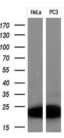 CDKN2A (p16INK4a) Mouse anti-Human, Clone: OTI2C5, lyophilized, TrueMAB