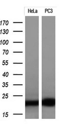 CDKN2A (p16INK4a) Monoclonal Antibody (OTI3F2), TrueMAB , OriGene 100 &mu;L;