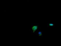 CDKN2B Mouse anti-Human, Clone: OTI8H4, lyophilized, TrueMAB 100 &mu;g;