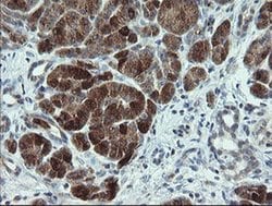 CDKN2B Monoclonal Antibody (OTI3B6), TrueMAB , OriGene 100 &mu;L; Unconjugated:Antibodies,