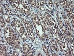 CDKN2B Monoclonal Antibody (OTI3B6), TrueMAB , OriGene 100 &mu;L; Unconjugated:Antibodies,