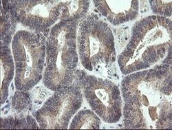 CDKN2B Monoclonal Antibody (OTI3B6), TrueMAB , OriGene 100 &mu;L; Unconjugated:Antibodies,