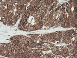 CDKN2B Mouse anti-Human, Clone: OTI8H4, lyophilized, TrueMAB 100 &mu;g;